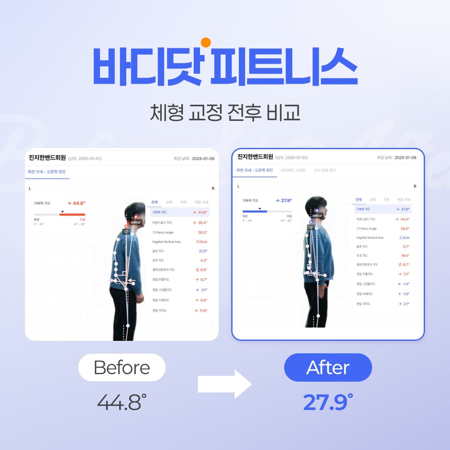 체형 교정 전후 데이터 변화